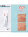 Avene Comedomed Peeling Creme Intensivo 40ml
