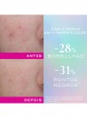 Nuxe Zinc Power Srum Anti-Imperfeies