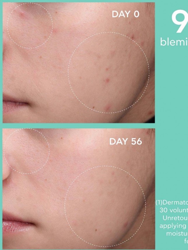 Just Bee Clear Crema Hidratante Matificante Anti-Imperfecciones 40ml