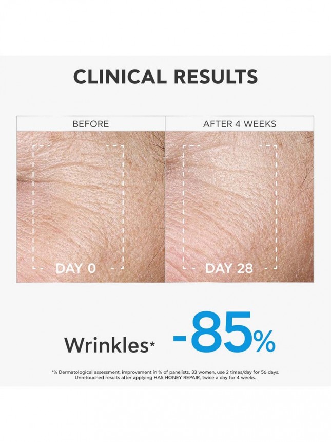 Apivita HA5 Serum Reparador Mel 30ml