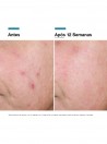 Skinceuticals Advanced RGN-6 Crema 50ml