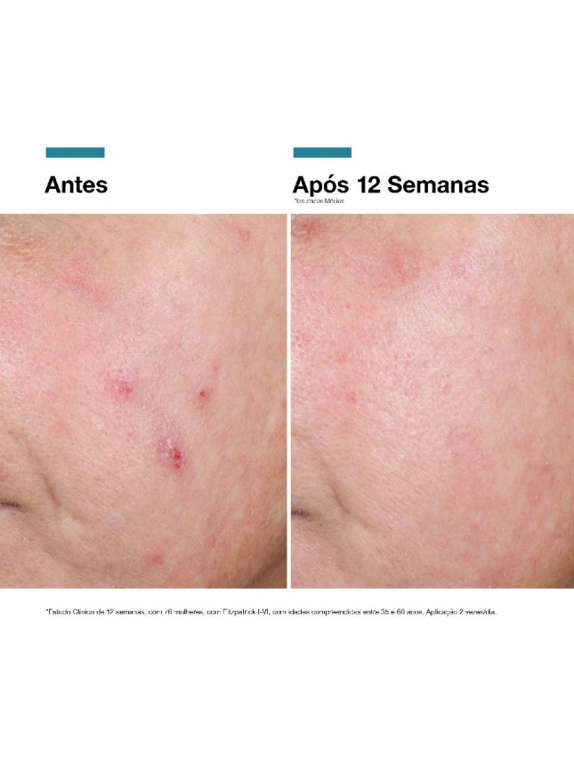 Skinceuticals Advanced RGN-6 Crema 50ml
