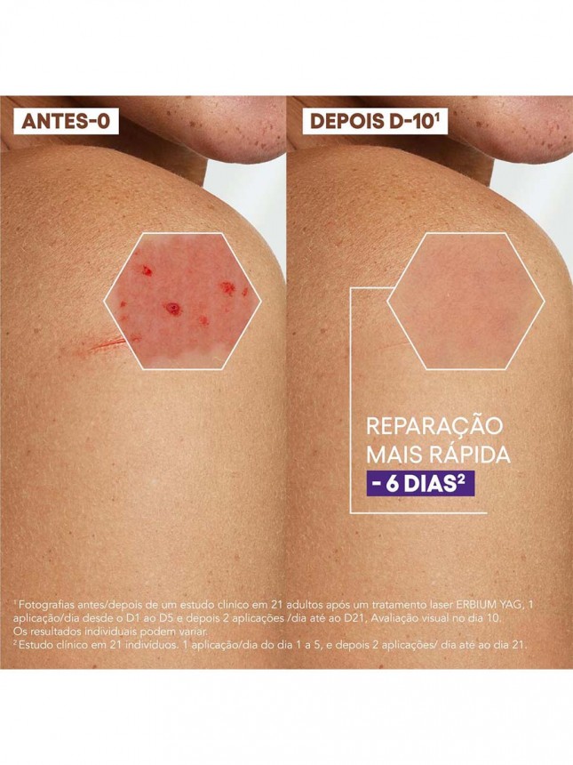 A-Derma Epithelial Ultra Repair Creme 100ml