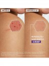 A-Derma Epithelial Ultra Repair Creme 40ml