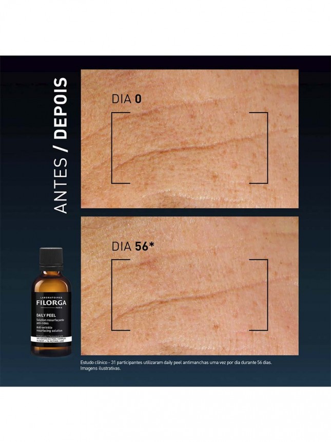 Filorga Dailypeel Soluci�n renovadora antiarrugas 50 ml