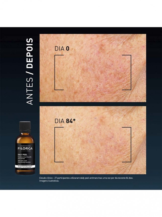 Filorga Dailypeel Soluci�n renovadora antimanchas 50 ml