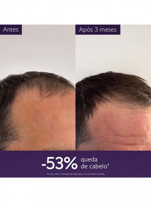 Caudalie Anti Hair Loss Serum 50ml