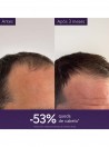 Caudalie Anti Hair Loss Serum 50ml